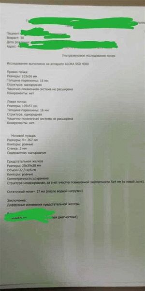 Важность понимания служебки