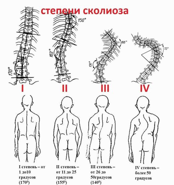 Нормативы по росту для призывников