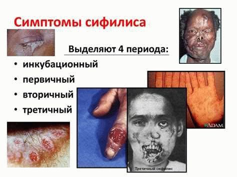 Применение Ст. 121 УК РФ в судебной практике