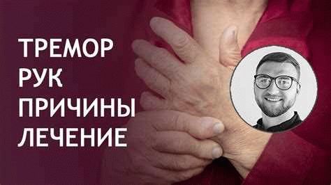 Тремор рук, ног и служба в армии